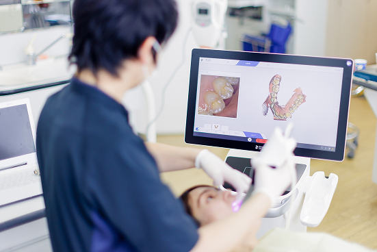 口腔内スキャナー